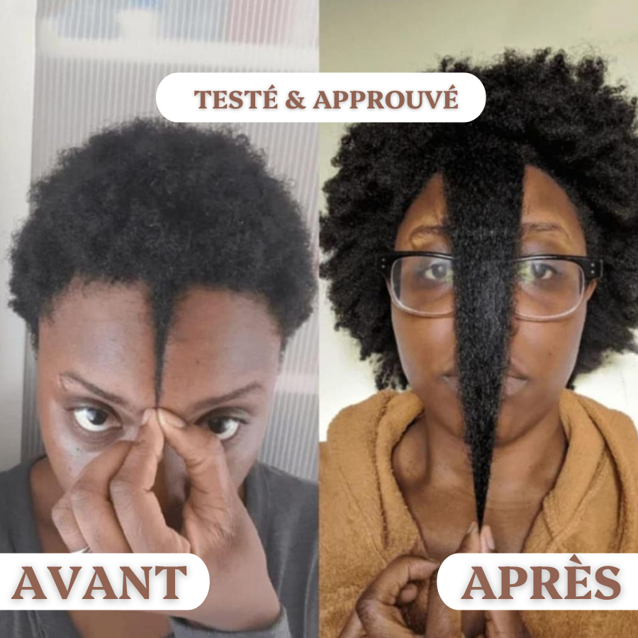 SanaHair™⎪Repousse Capillaire Au Batana